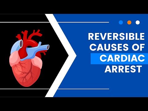 Recognize & Revive: Mastering Reversible Causes of Cardiac Arrest
