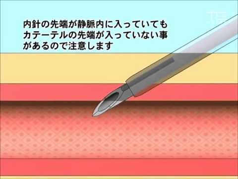 使用方法解説 シュアシールド サーフロー Ⅱ（フラッシュタイプ）