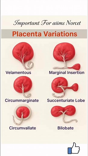 61K views · 335 reactions | 喙✨ Placenta Variations – Must Know for...