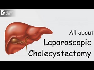 All about Laparoscopic Cholecystectomy - Dr. Paramesh K N