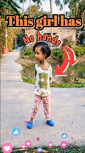 This girl has no hands #viral #shortvideos #kids #memes #most #nohands#doctor #eyecatchy