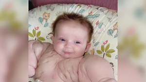 1.3K views | 'Baby Hulk': Bebé nace con rara condición genética y su madre asegura que es una superheroína. ✅ Sigue esta y más noticias las 24 horas en ViX  https://bit.ly/37q2XXw | Univision Orlando | Facebook