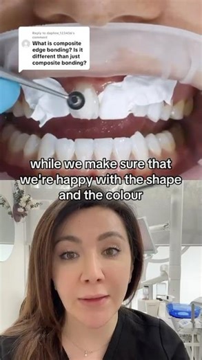 Does Composite Bonding Need Shaving Your Teeth?!