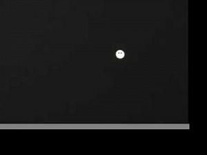 Tracking or Smooth Pursuit in Videonystagmogram (VNG) testing