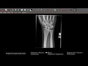 [XR] Wrist Radiograph | Search Pattern