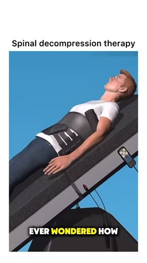 Animations on Instagram: "Follow @surgicalanimation for more! 🏥"