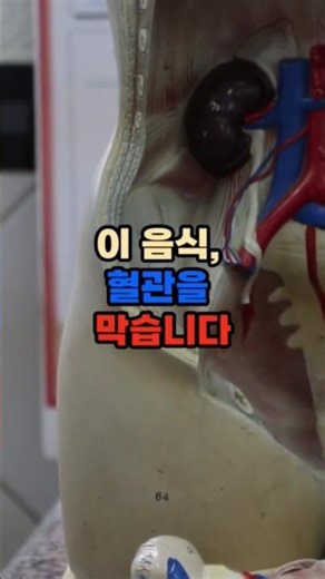 “기름진 음식, 뇌경색을 부르는 가장 빠른 길”