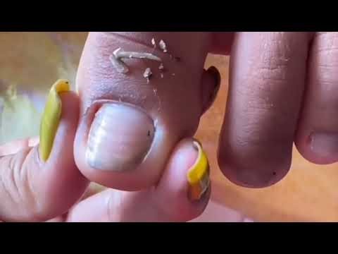 How to Keep Toenails Clean, Trimmed, and Healthy for All Ages