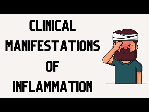 INFLAMMATION SIGNS AND SYMPTOMS | Systemic & Local