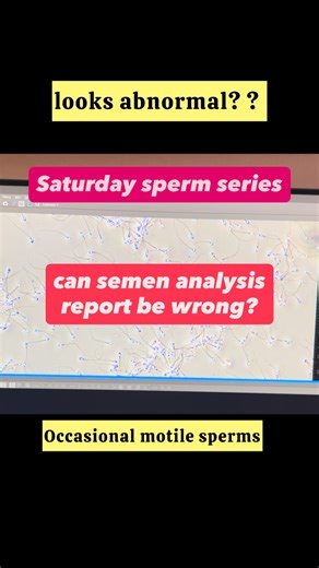 Semen analysis should be processed within 30–60 minutes of collection. Any delay in handling, processing, or reporting can alter parameters like motility, morphology, and vitality — leading to a wrong or misleading report. #SemenAnalysis #MaleFertility #FertilityAwareness #Andrology #IVFClinic #FertilityFacts #ReproductiveHealth #InfertilityAwareness #LabAccuracy #FertilitySpecialist #IVFJourney #MaleInfertility #FertilityTesting #FertilityDoctor #AccurateDiagnosis #FertilityLab #FertilityCare #