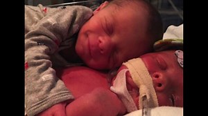 Newborn seen hugging twin in viral photo dies of rare condition