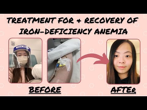 Iron Deficiency Anemia Treatment: My Recovery Story.