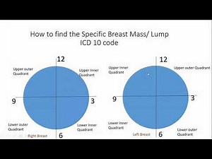 ICD 10 Coding Guide for Breast Mass/Lump (N63 series)
