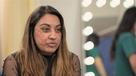 2.5M views · 26K reactions | Rimi, a young woman who is grappling with a rare and excruciating skin condition, visits Dr. Emma, hoping she can devise a plan to alleviate her struggles. #TheBadSkinClinic Watch full episodes on discovery+: https://bit.ly/3HfHr6e | Love Reality | Facebook