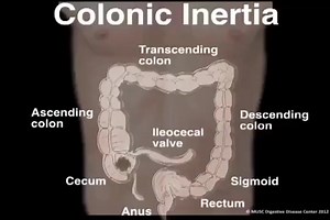 27 reactions | The colon, also known as the large intestine, is a...