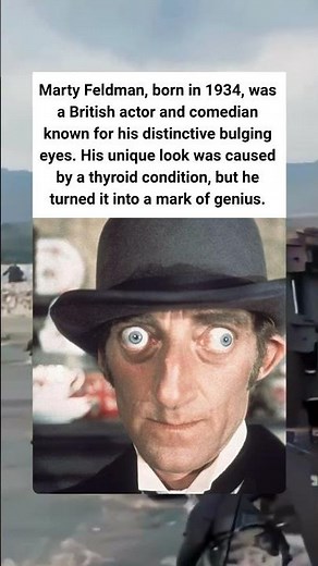👀 The Eyes of Marty Feldman