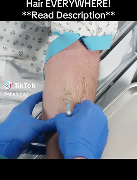 IV Insertion Techniques for Nurses: Tips and Solutions