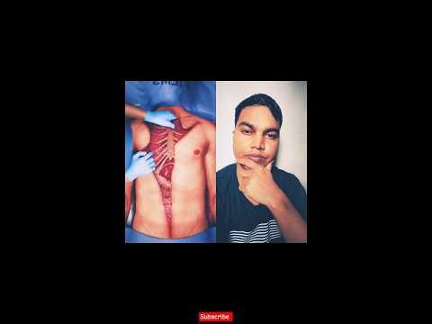 How is a postmortem done on a human being and why? (3D) #tranding #views #shorts