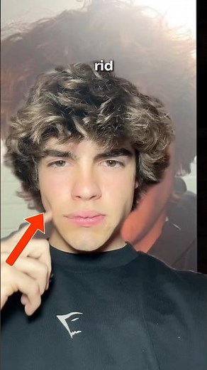 How to get rid of chubby cheeks 🤝