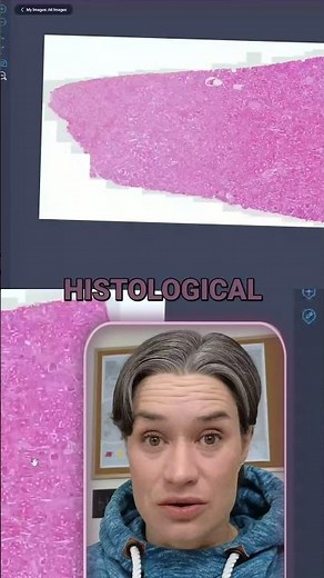 Histological strucutes of a Kidney | Kidney Under the microscope