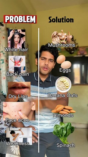 5.2K reactions · 397 shares | If your body shows signs, it’s asking for nutrients fix the deficiency, not just the symptom. #WellnessTips #weightgain #gaining #weightloss #fatloss #diet #ChestWorkout #MuscleBuilding #FitnessTips #ChestDay #Bodybuilding #StrengthTraining #GymLife #WeightLoss #FatLoss #HealthyEating | Rushi-lifts | Facebook