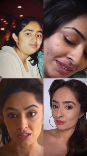 Try this simple Face Yoga exercise daily to help your face #faceyogabyvibhutiarora #faceyoga #shots