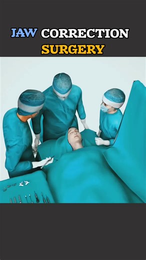 How Jaw Correction Surgery Works | 3D Orthognathic Animation #OrthognathicSurgery #JawCorrection #3DMedicalAnimation #MaxillofacialSurgery #MedicalVisualization