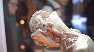 ¡"BODIES, Cuerpos Humanos Reales" regresa a Puerto Rico! La exposición más vista de la historia en todo el mundo, presenta cuerpos humanos reales con más de 100 órganos humanos, que revelan cómo funciona el mismo, con detalles y estructuras de distribución. Disfruta de esta increíble exposición en Plaza Las Américas. Boletos en ticketera.com | Ticketera
