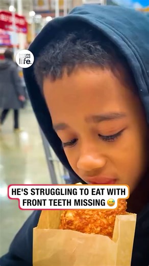 31K views · 184 reactions | Child eating with front teeth missing | Lessons Learned In Life | Facebook