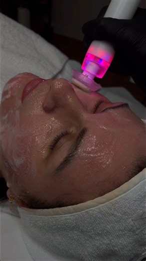 ✨NEW TREATMENT✨ Prep & Glow oxygenating pods are a powerful new addition to the CACI facial system, designed to deliver a high tech cleansing boost! When combined with CACIS CO2 activator gel, the pod releases micro-CO2 bubbles that trigger the Bohr effect, increasing oxygen delivery to the skin. This enhances cell metabolism, boosts circulation and restores radiance. Infused with kojic acid, vitamin C, alpha arbutin and other active ingredients the prep & glow pod targets full, uneven skin prom