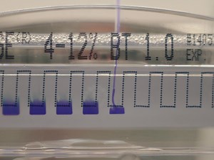 A Guide to Modern Quantitative Fluorescent Western Blotting with Troubleshooting Strategies