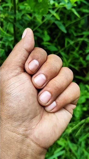 Unique spider from ASIA #anyuniqueanimals #shorts