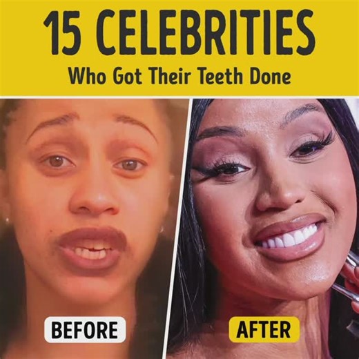 85K views · 91 reactions | 15 Celebrities Who Transformed Their Smiles with Dental Work | Bright Side | Facebook