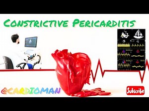 Echocardiographic Findings for Constrictive Pericarditis👆#echocardiography