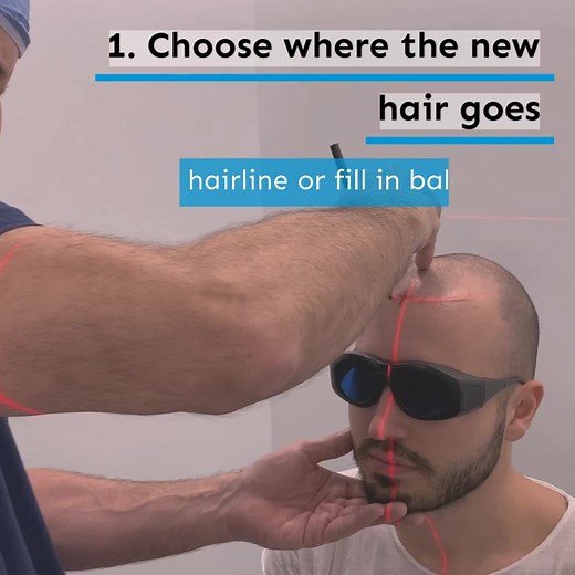 1.2K views · 19 reactions | 퐁퐚퐥퐝퐢퐧퐠 퐢퐧 퐇퐨퐮퐬퐭퐨퐧? 퐖퐞 퐜퐚퐧 퐟퐢퐱 퐢퐭.” Hair restoration changes lives. We helped 40,000+ patients get their hair and confidence back. Why Advanced Hair? ✅ Simple 1-day treatment ✅ Uses your real hair ✅ Permanent results | Advanced Hair Restoration | Facebook