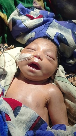 Baby not crying after birth #newbornbaby #nicu | Medical practice