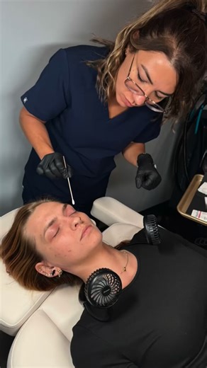 ✨ The Perfect Derma Peel: Your Skin’s Reset Button ✨ Not just a peel...