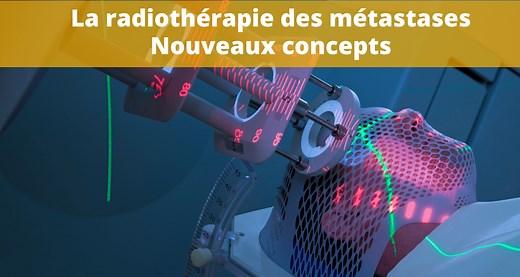La radiothérapie des métastases dans le traitement des cancers