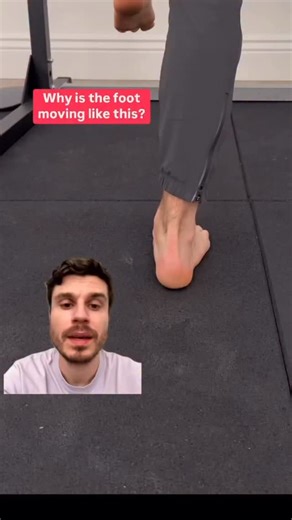 Trying to understand “why” someone is moving in a certain way is a question rehab practitioners are always trying to answer, but it’s a very challenging question to answer with certainty In the video above, many may be quick to blame a big toe that can’t extend, or a foot that struggles to pronate But these are kinematic representations We must also consider how FORCES are influencing the strategy the client is using (kinetic representation) Give yourself the opportunity to go deeper with your a
