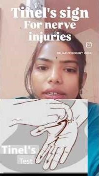 #tinels'sign#nervedamage#parasthesia#howtofindoutnervedamage or not#physiotherapytreatment #ytshorts