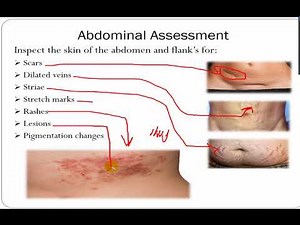ASSESSMENT OF ABDOMEN, RECTUM AND ANUS