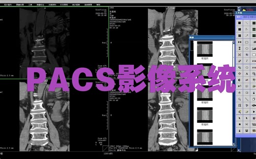 C  医学影像存储与通信系统PACS源码