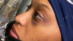 Here's how details diverge in the telling of 3 alleged police brutality cases in Paterson