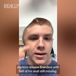2.1M views · 40K reactions | The one-in-a-million survival story of Brandon who lives with half a skull 梁 #BodyBizarre | Really Channel | Facebook
