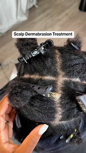 16K views · 267 reactions | Your scalp is skin .. and it deserves the...