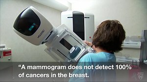 When should women start getting mammograms to screen for breast cancer? With changing guidelines, it may be difficult to determine the best plan of action. Dr. Amy Degnim says women should know the risks and benefits of mammography, as well as their own risk of breast cancer. That information can help women decide when to start screening and if they'd benefit from additional screening technologies. https://mayocl.in/2RrF19F | Mayo Clinic
