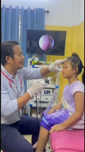 Close-Up Endoscopic Nose Exam 👃🩺 #NoseHealth #ENTDoctor