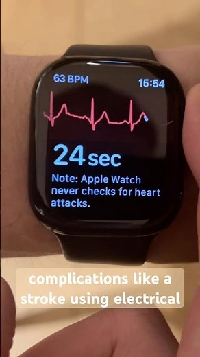 AFib Detection: How Your Apple Watch Could Save Your Life! 💓 #atrialfibrillation #afib