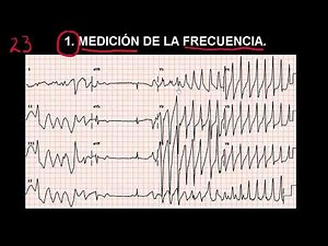 23 FREQUENCY RATE | ELECTROCARDIOGRAPHY (ECG) ONLINE COURSE