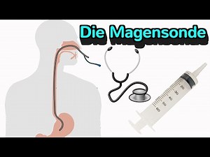 Everything you need to know about the nasogastric tube